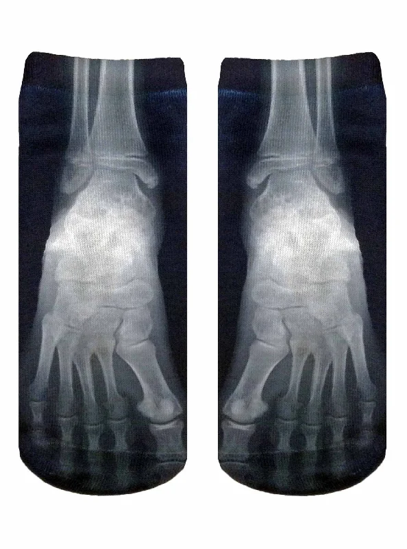 Don't Delay X Ray Ankle Socks